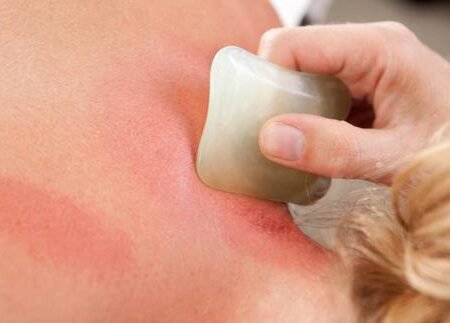 Você conhece a técnica Chinesa Gua Sha?