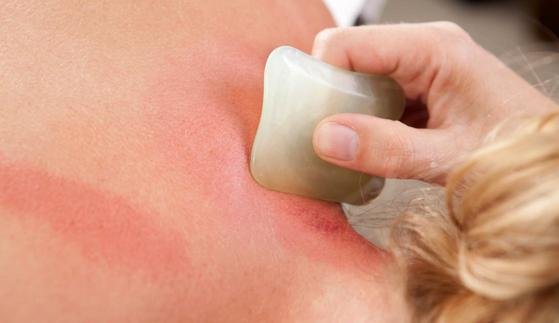 Você conhece a técnica Chinesa Gua Sha?